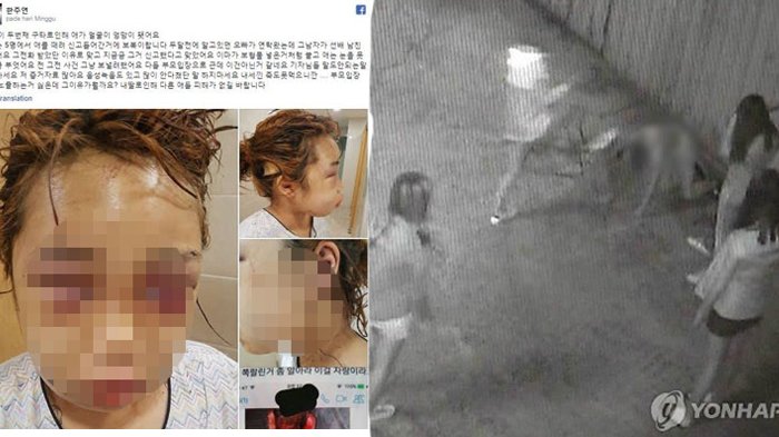 Bullying di Korea Selatan. Salah satu jenis Bullying Physical yang sering terjadi anehnya pemerintah dan sekolah seakan tutup mata akan masalah inii